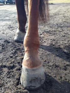 kronisk_lymfangit_etter_to_behandlinger